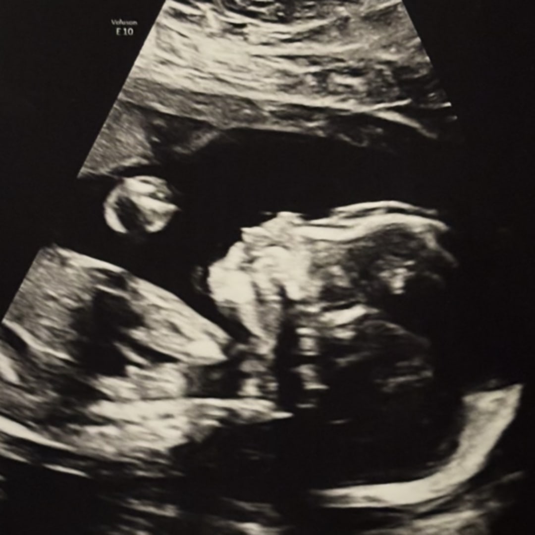Photo shared by Dani for their Babylist baby registry.
