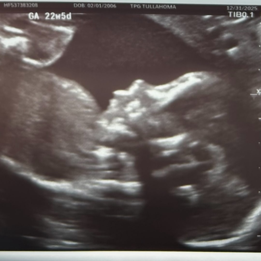 Photo shared by Allie for their Babylist baby registry.