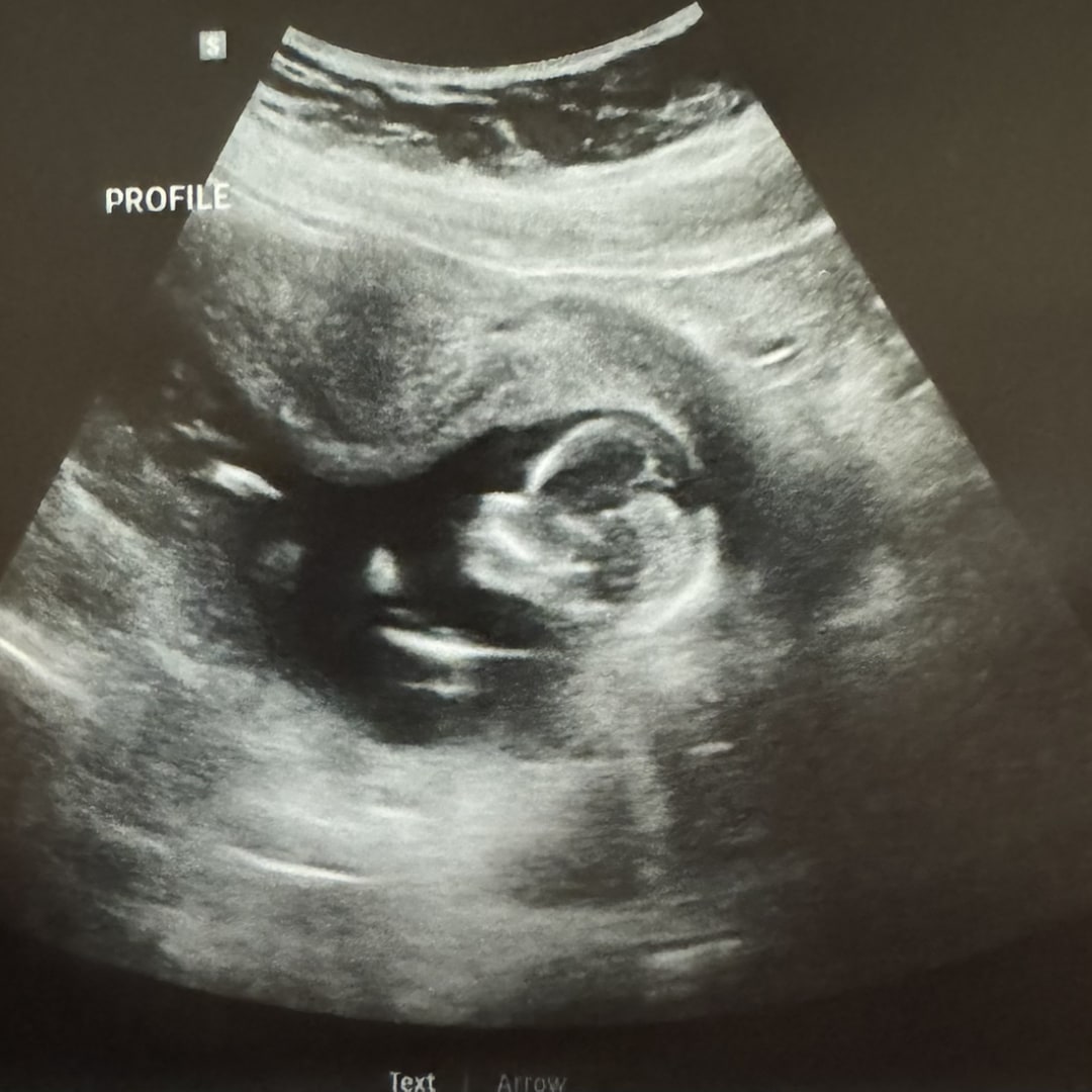 Photo shared by Jennifer for their Babylist baby registry.