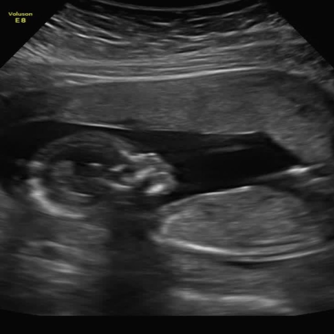 Photo shared by Gabriella for their Babylist baby registry.