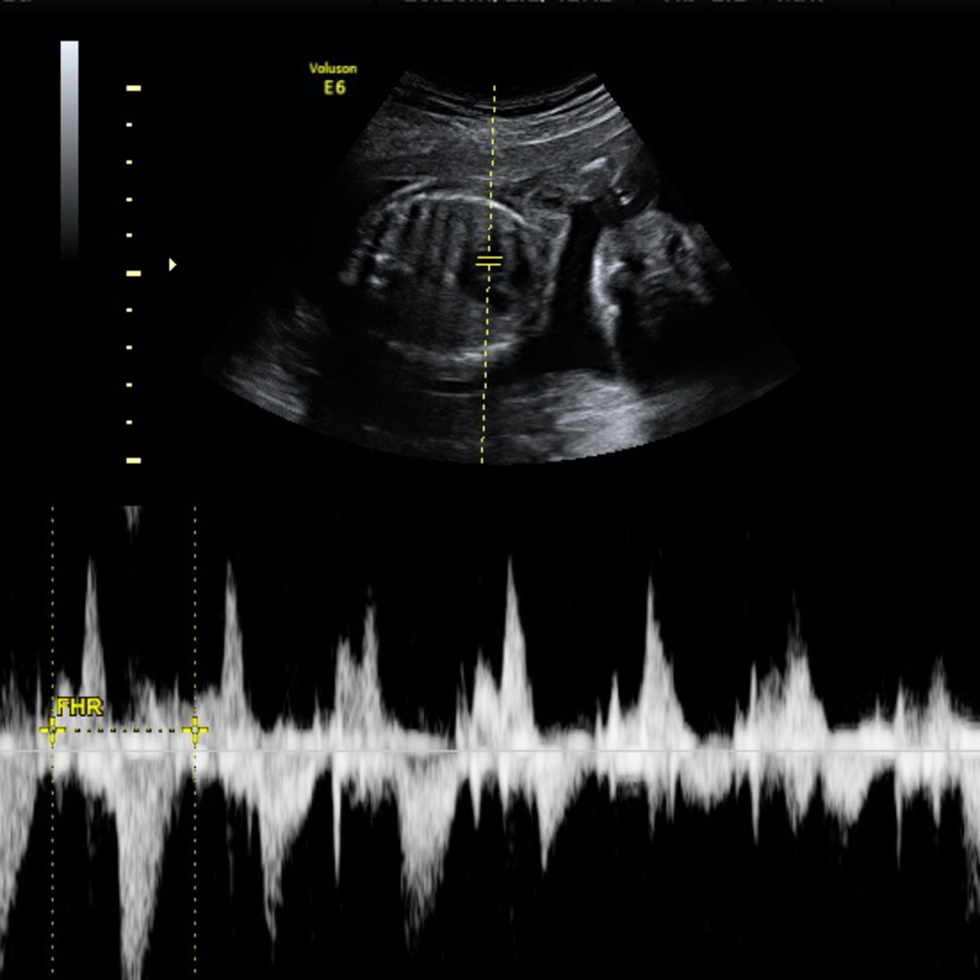 Photo shared by Lexi for their Babylist baby registry.