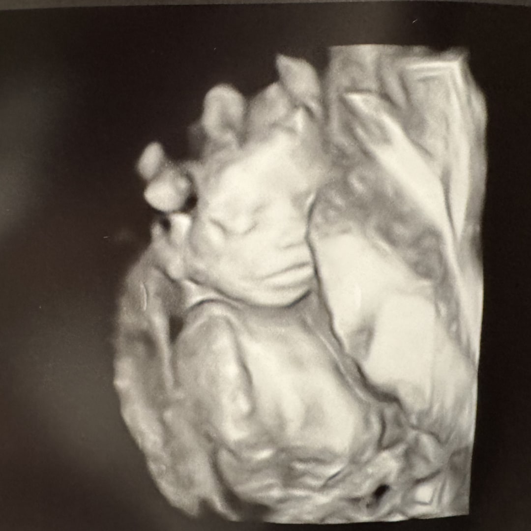 Photo shared by Dierk & Annie for their Babylist baby registry.