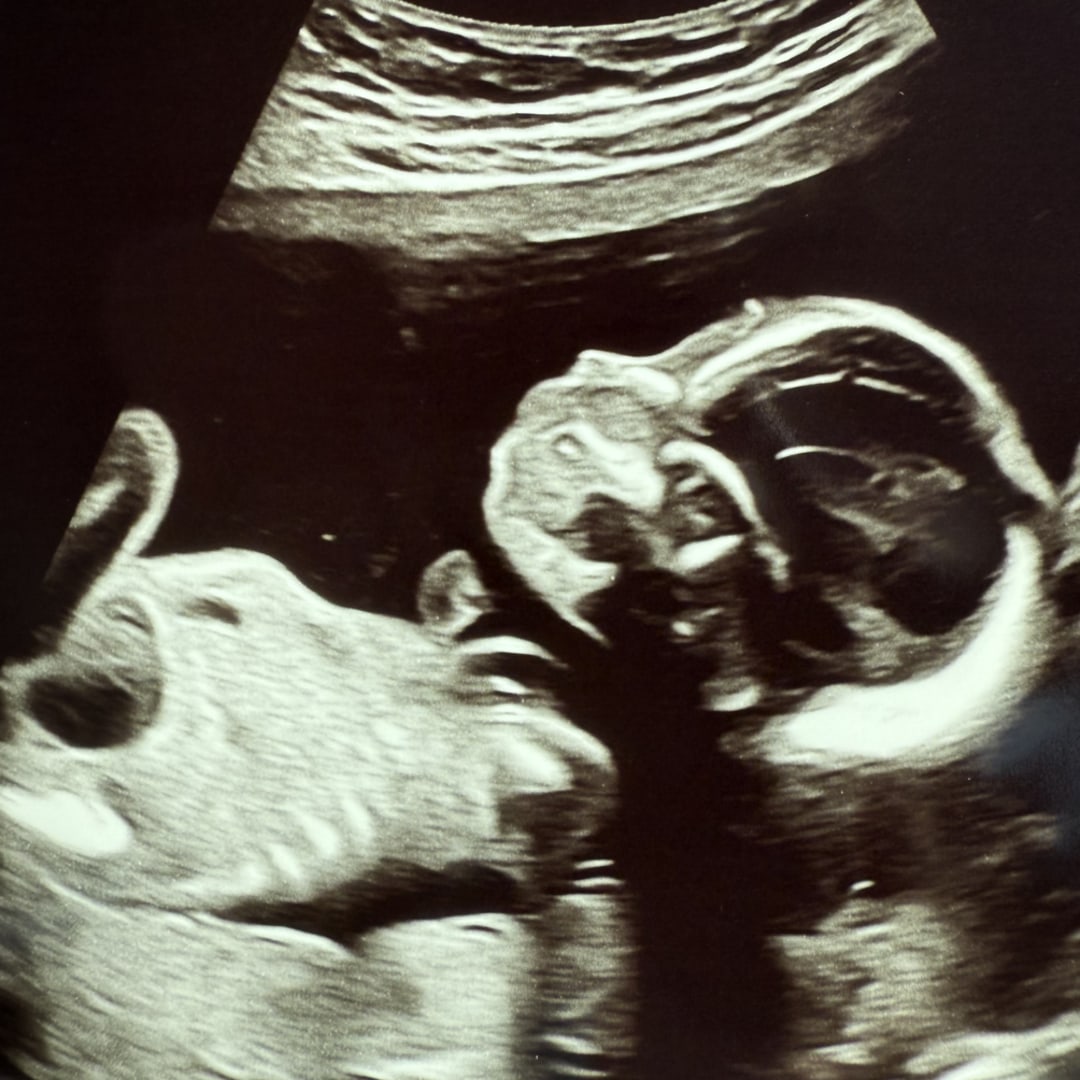 Photo shared by Julieth for their Babylist baby registry.