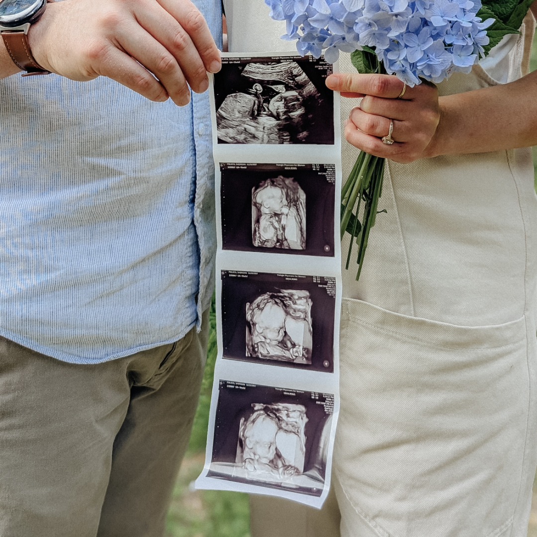 Photo shared by Sheridan for their Babylist baby registry.