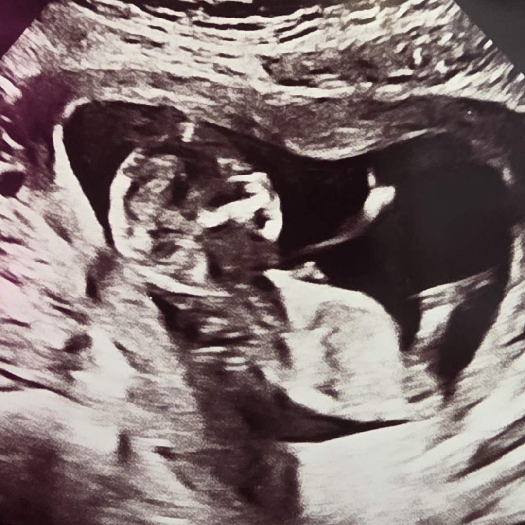 Photo shared by Rachel for their Babylist baby registry.