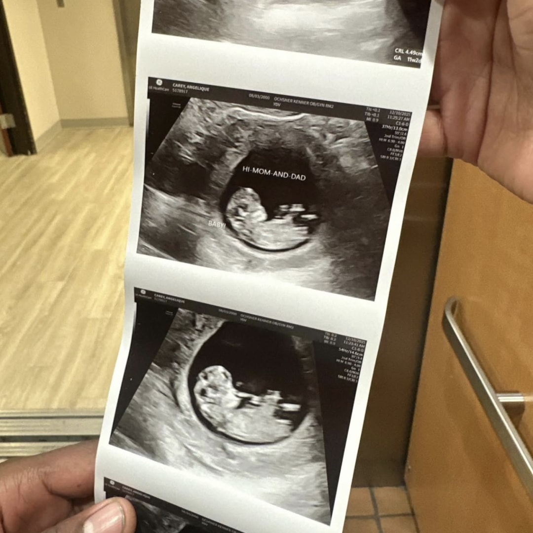 Photo shared by Angelique for their Babylist baby registry.