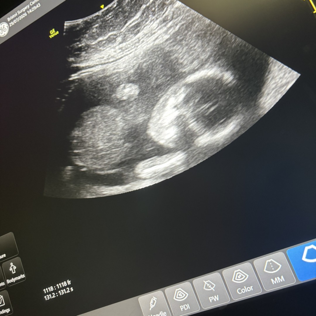 Photo shared by Tricia for their Babylist baby registry.