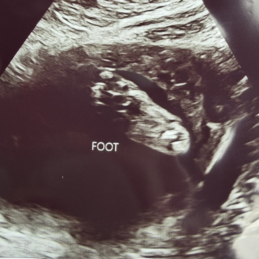 Photo shared by Teanna for their Babylist baby registry.