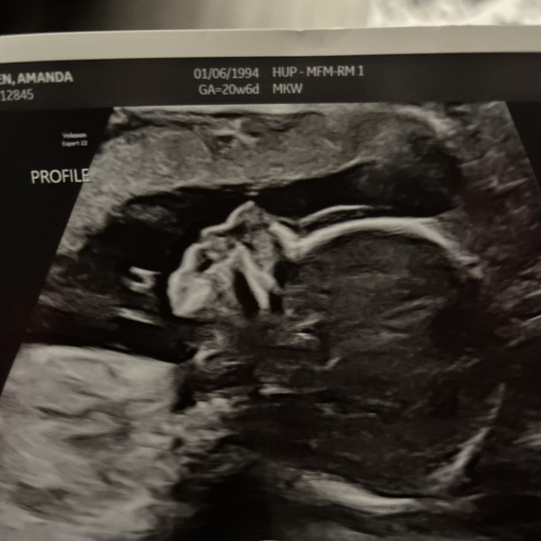Photo shared by Amanda for their Babylist baby registry.
