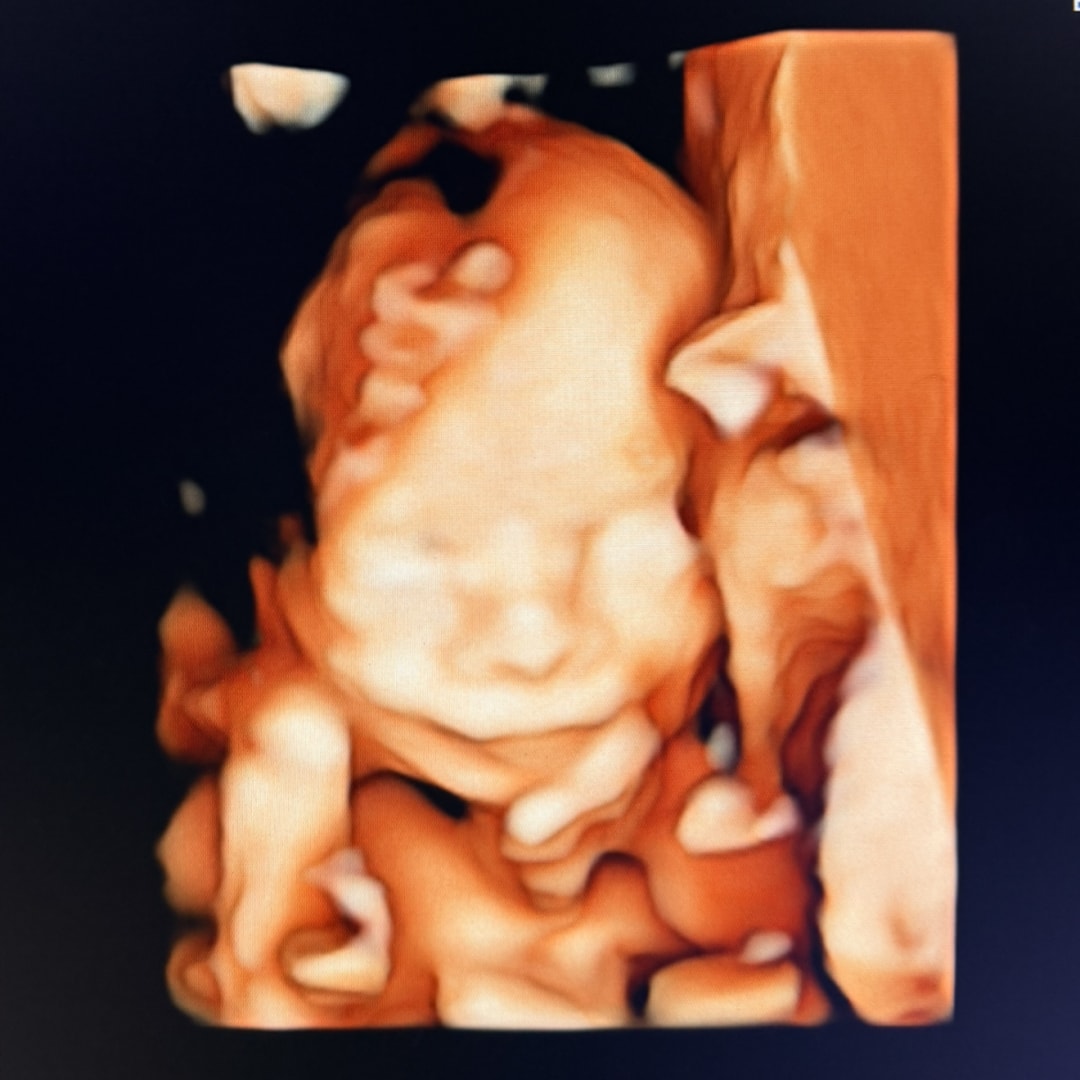 Photo shared by Brandin for their Babylist baby registry.