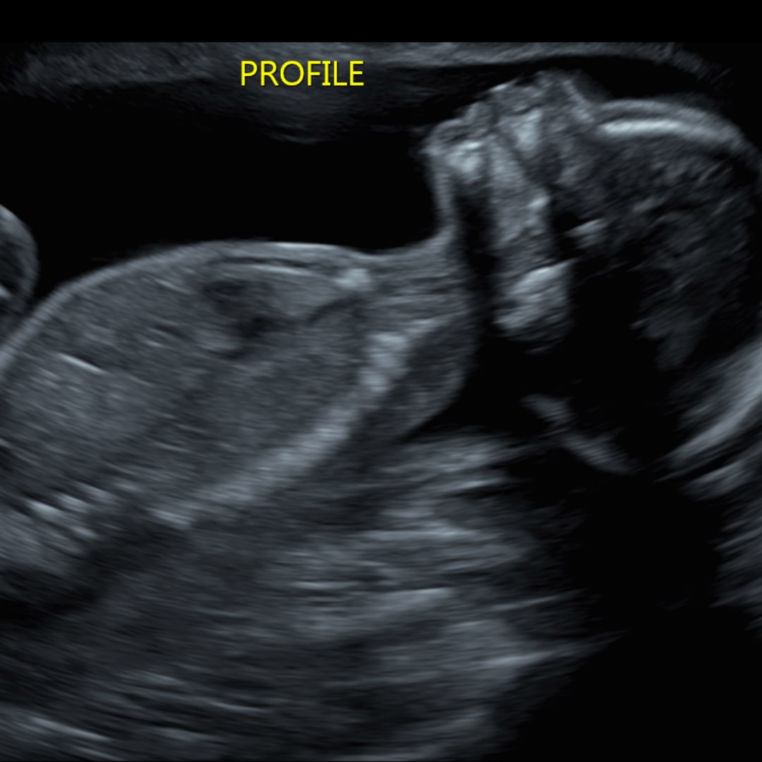 Photo shared by Jenni for their Babylist baby registry.