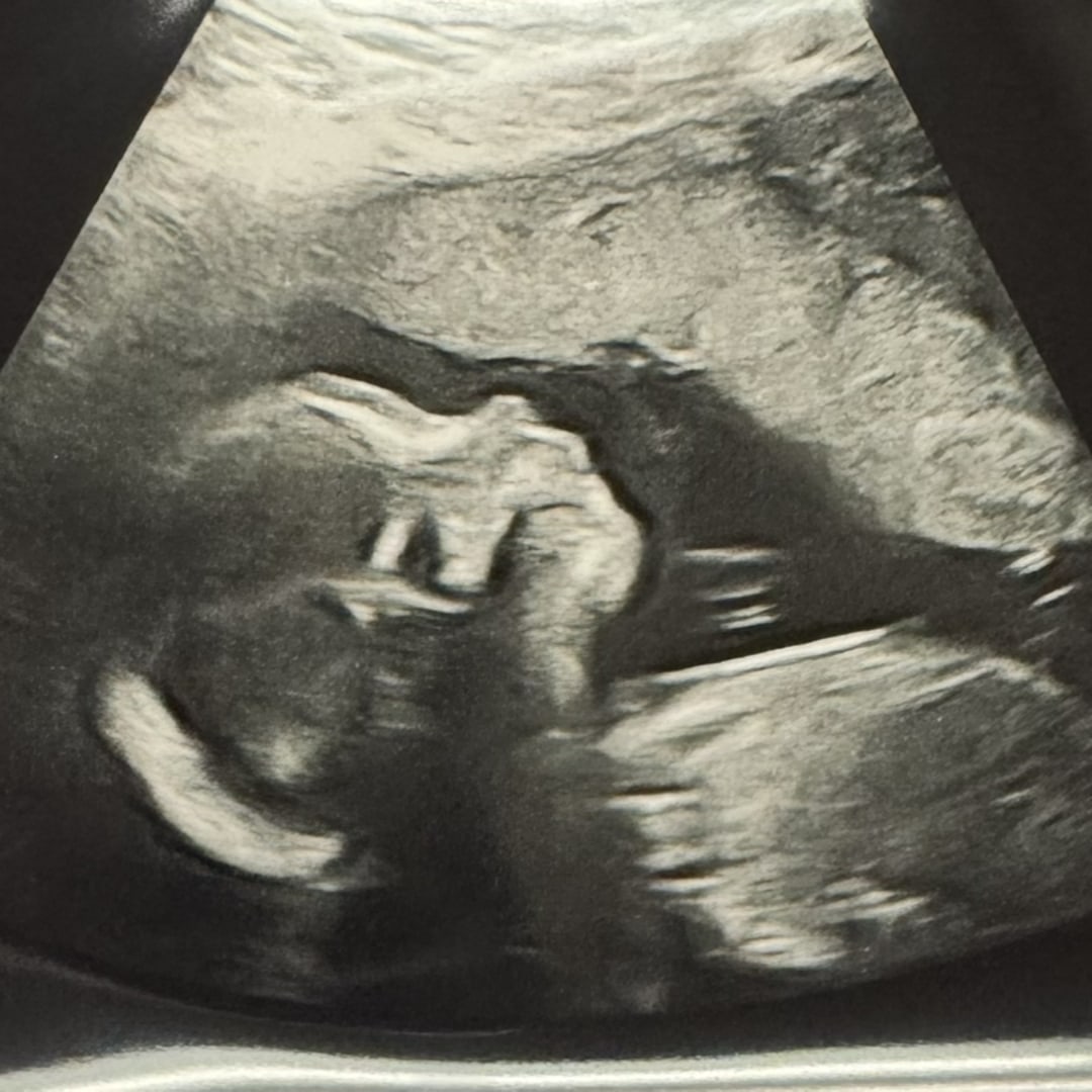 Photo shared by Madison for their Babylist baby registry.