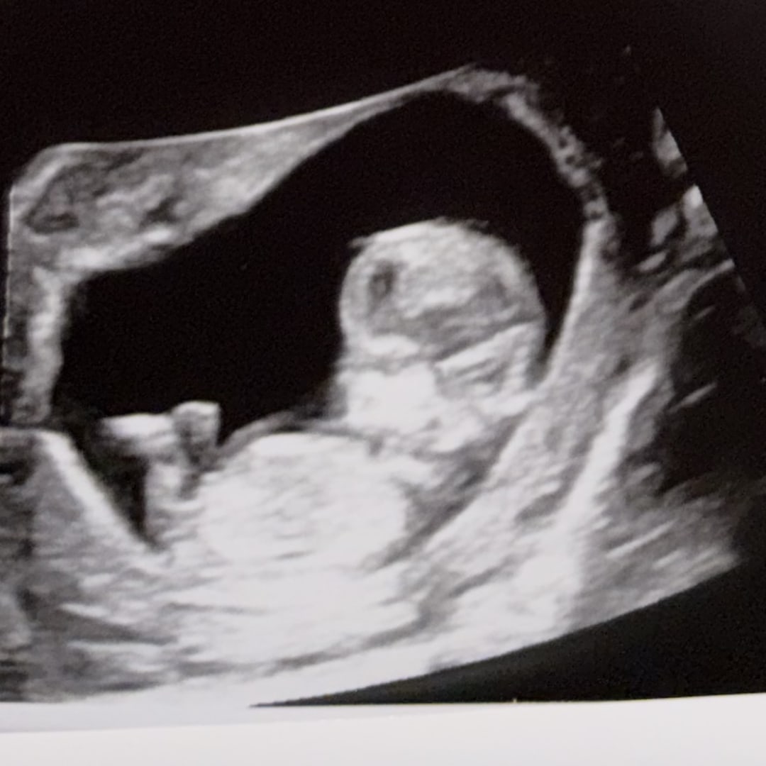 Photo shared by Brenna for their Babylist baby registry.