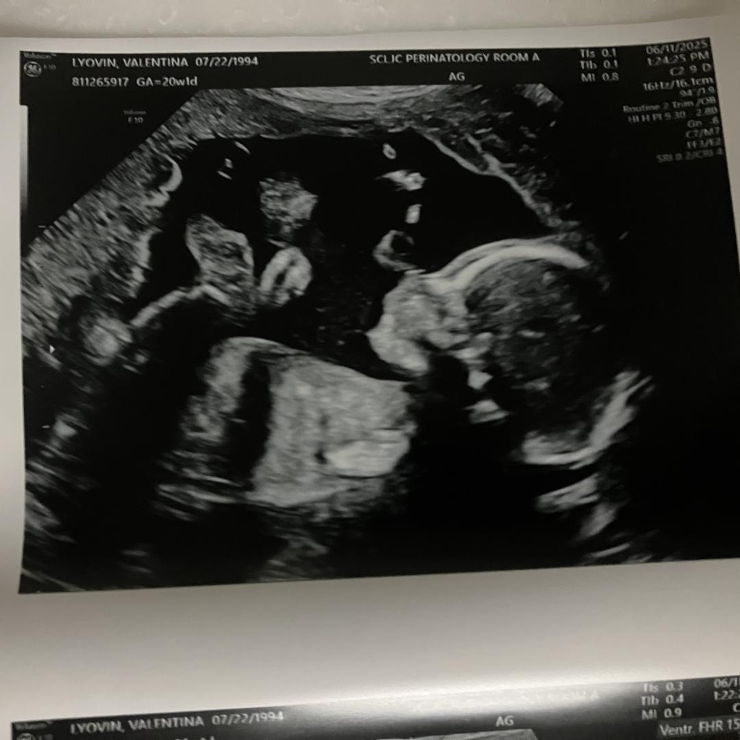 Photo shared by Valentina for their Babylist baby registry.