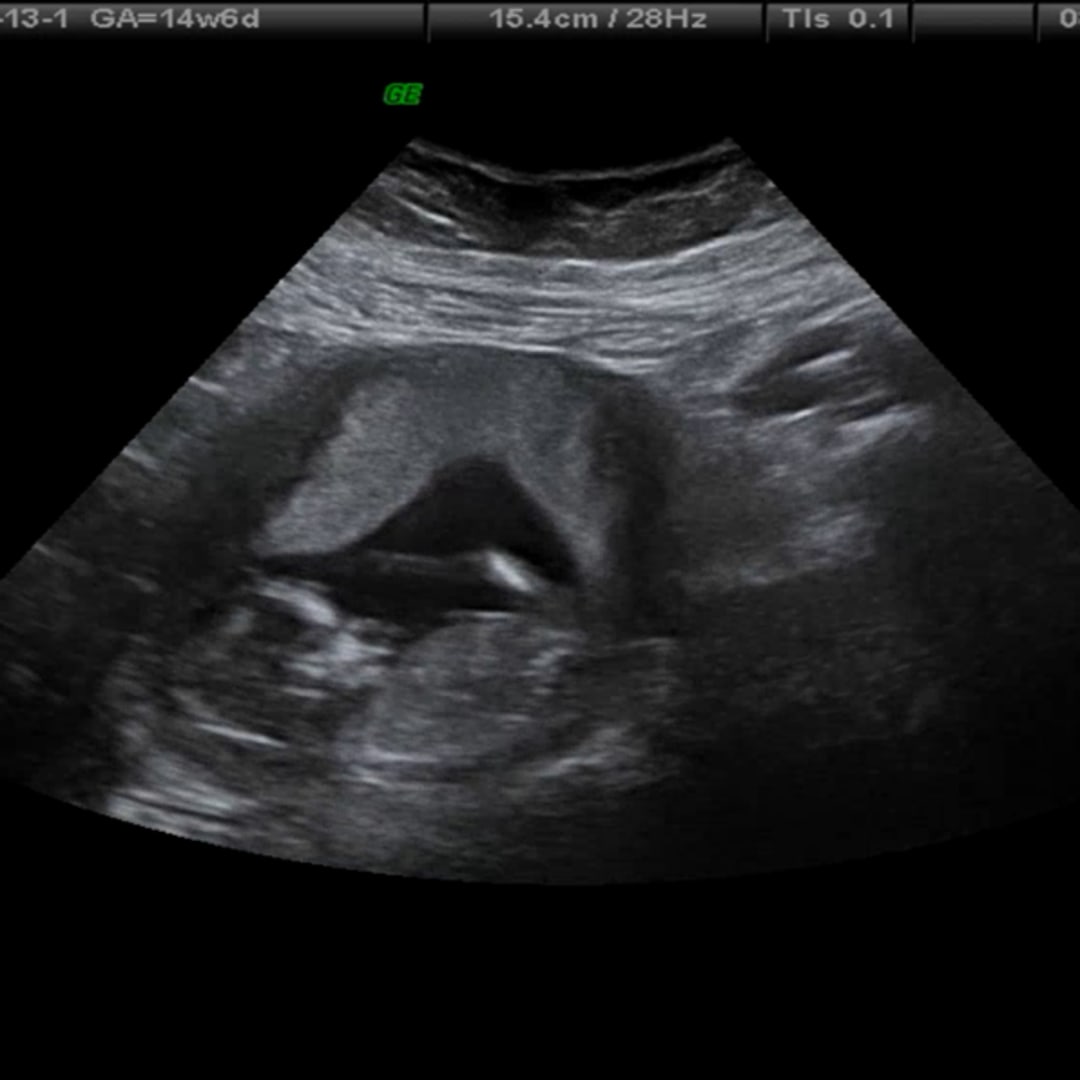 Photo shared by Katelyn for their Babylist baby registry.