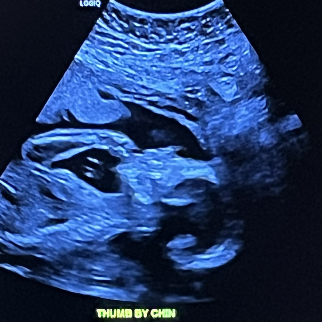 Photo shared by Samantha for their Babylist baby registry.