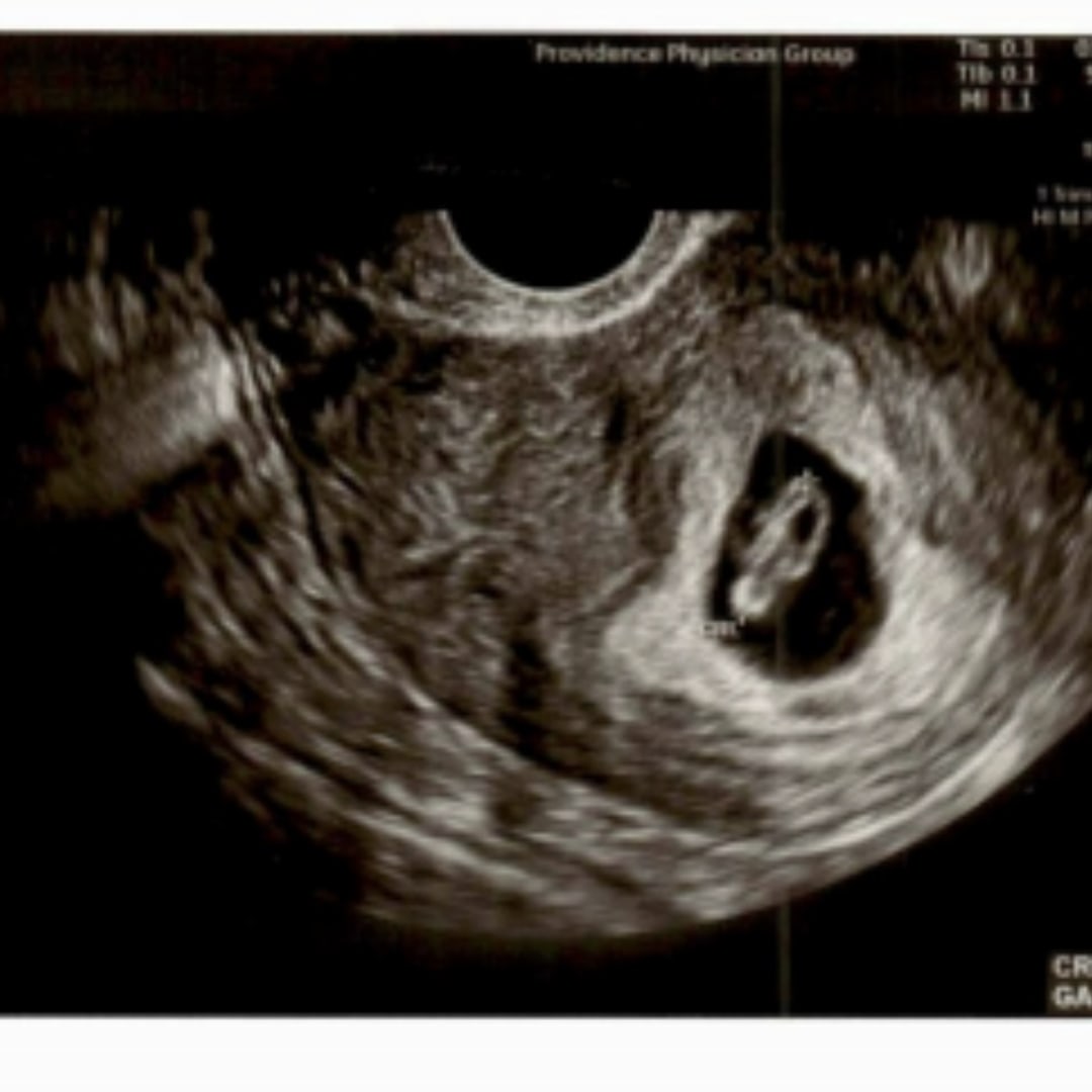 Photo shared by Anela for their Babylist baby registry.