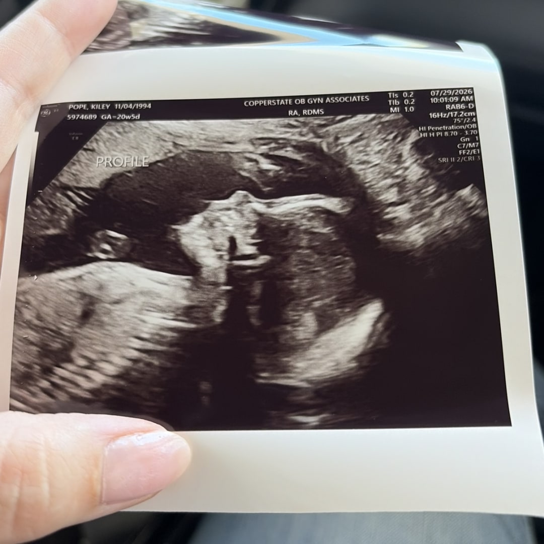 Photo shared by Kiley for their Babylist baby registry.