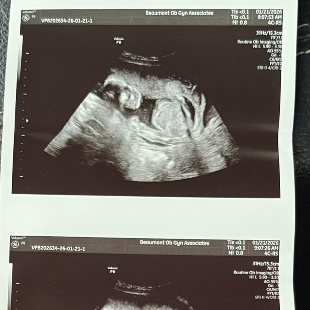 Photo shared by Miranda for their Babylist baby registry.