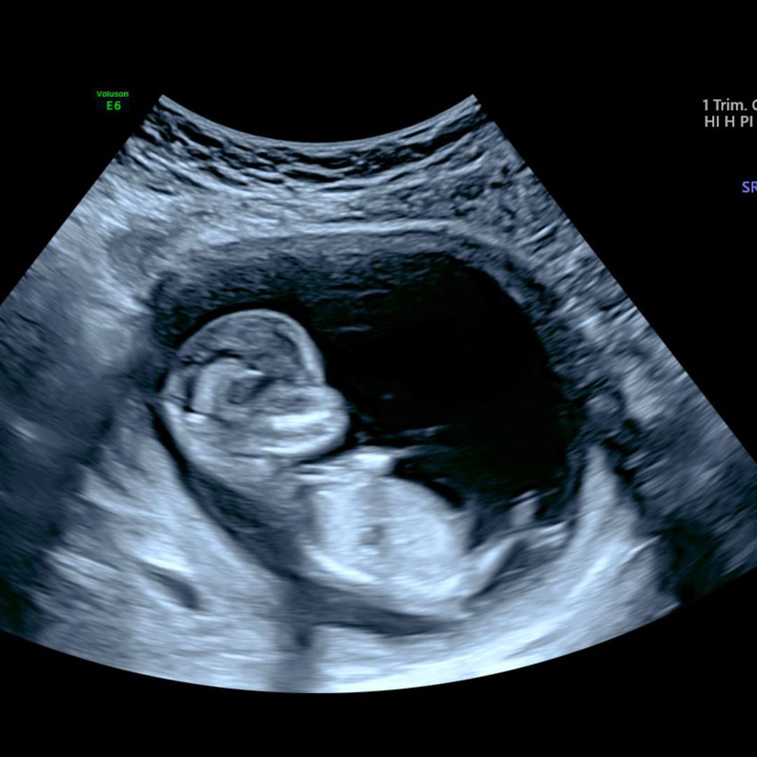 Photo shared by Taylor for their Babylist baby registry.