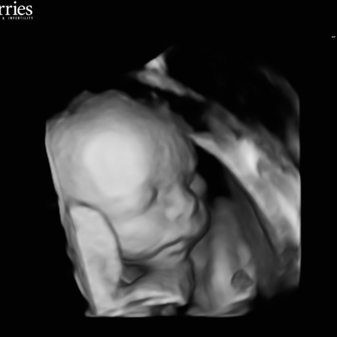 Photo shared by Paige for their Babylist baby registry.