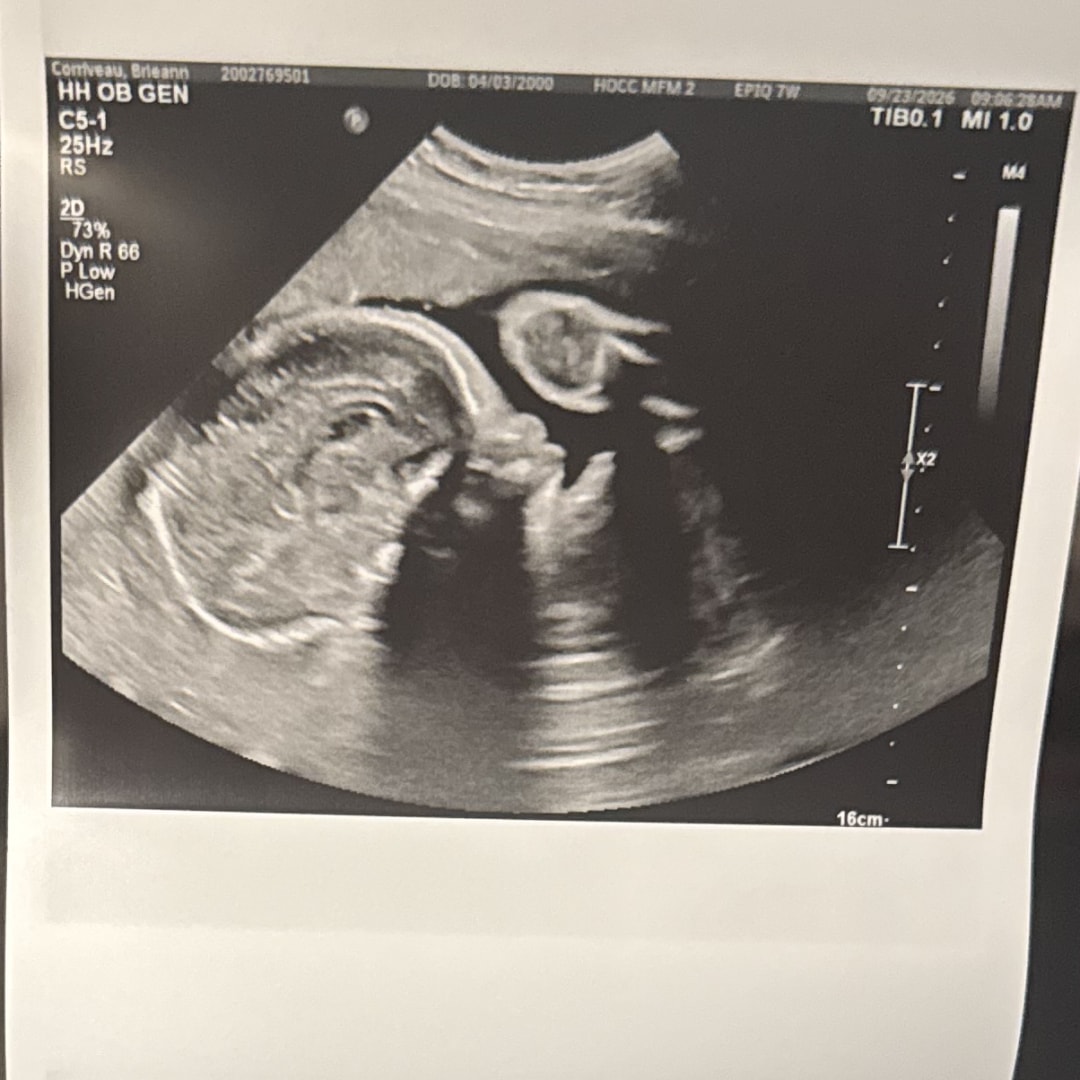 Photo shared by Brie-ann for their Babylist baby registry.