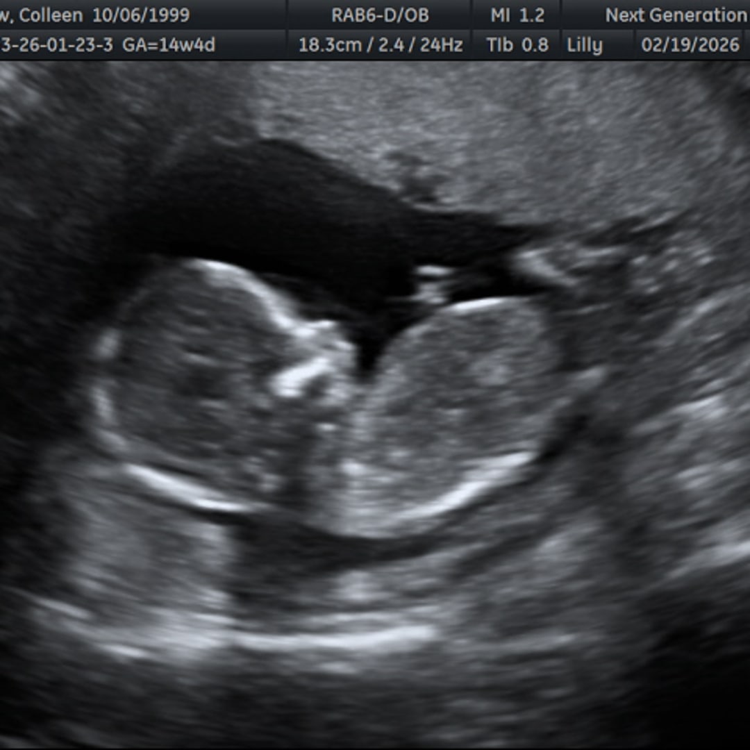 Photo shared by Colleen for their Babylist baby registry.