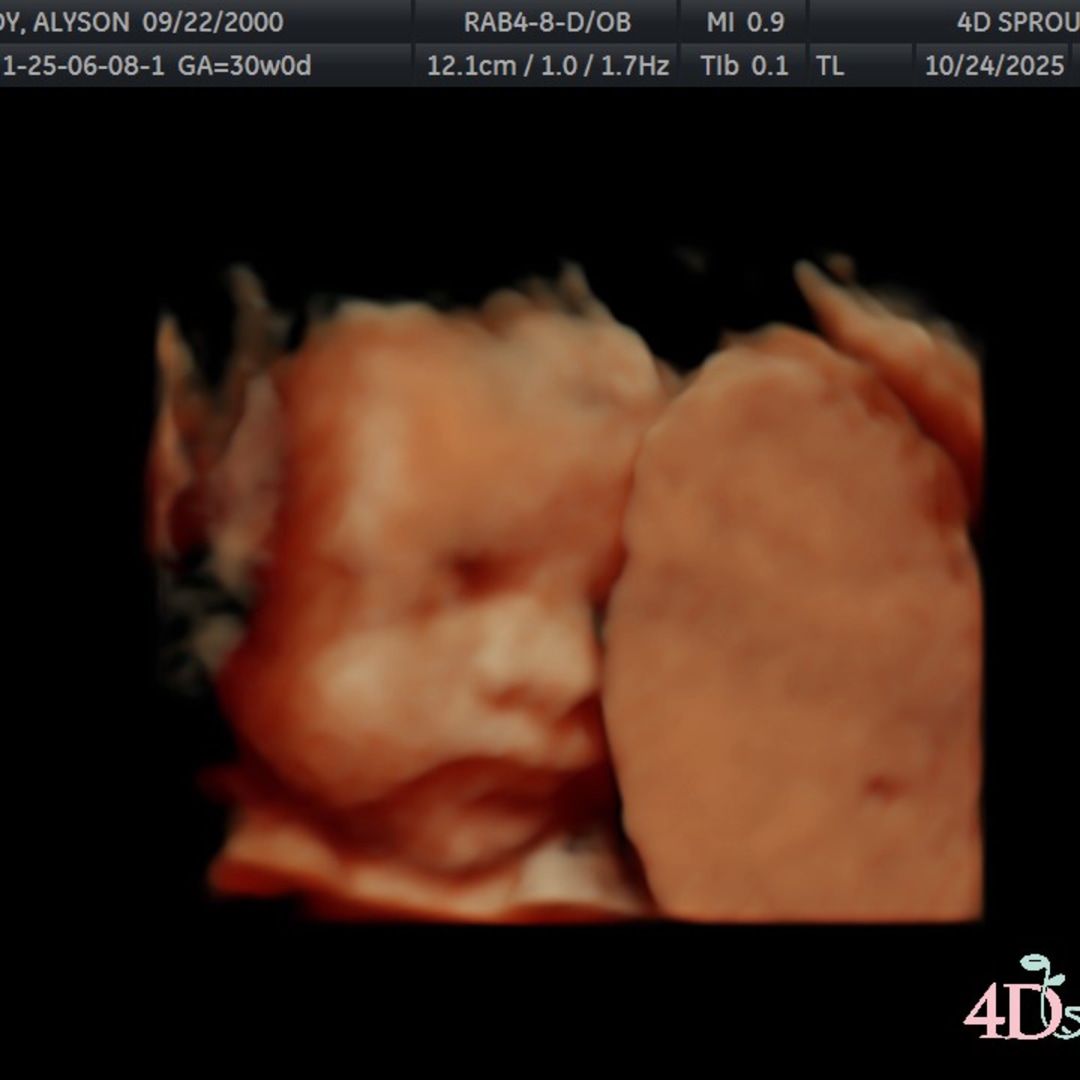 Photo shared by Alyson for their Babylist baby registry.