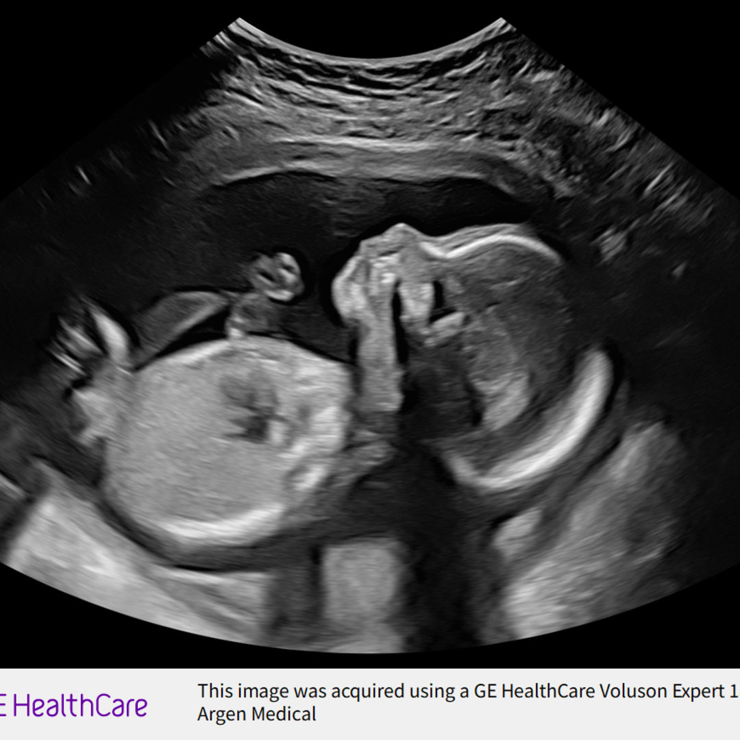 Photo shared by Camille for their Babylist baby registry.