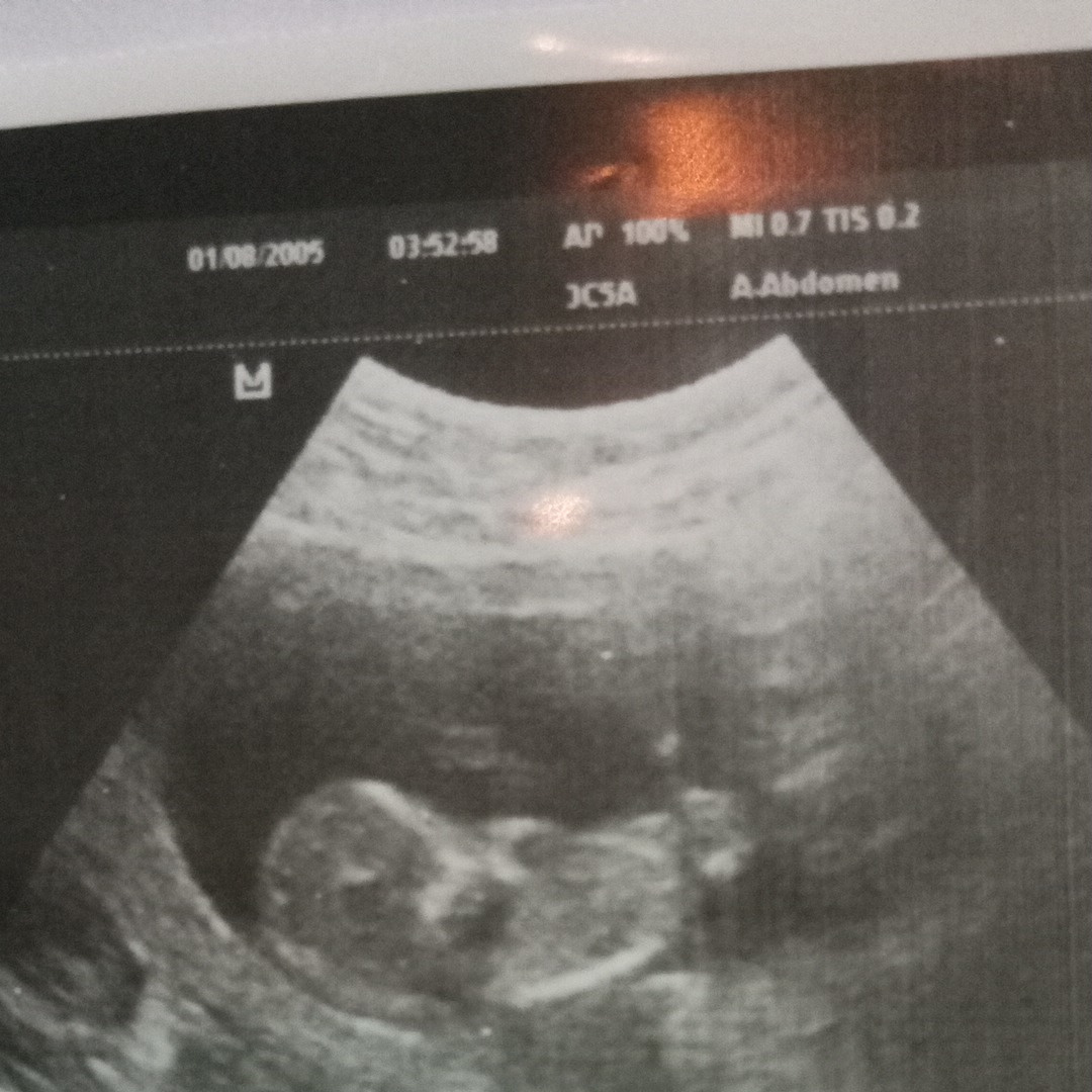 Photo shared by Yudit for their Babylist baby registry.
