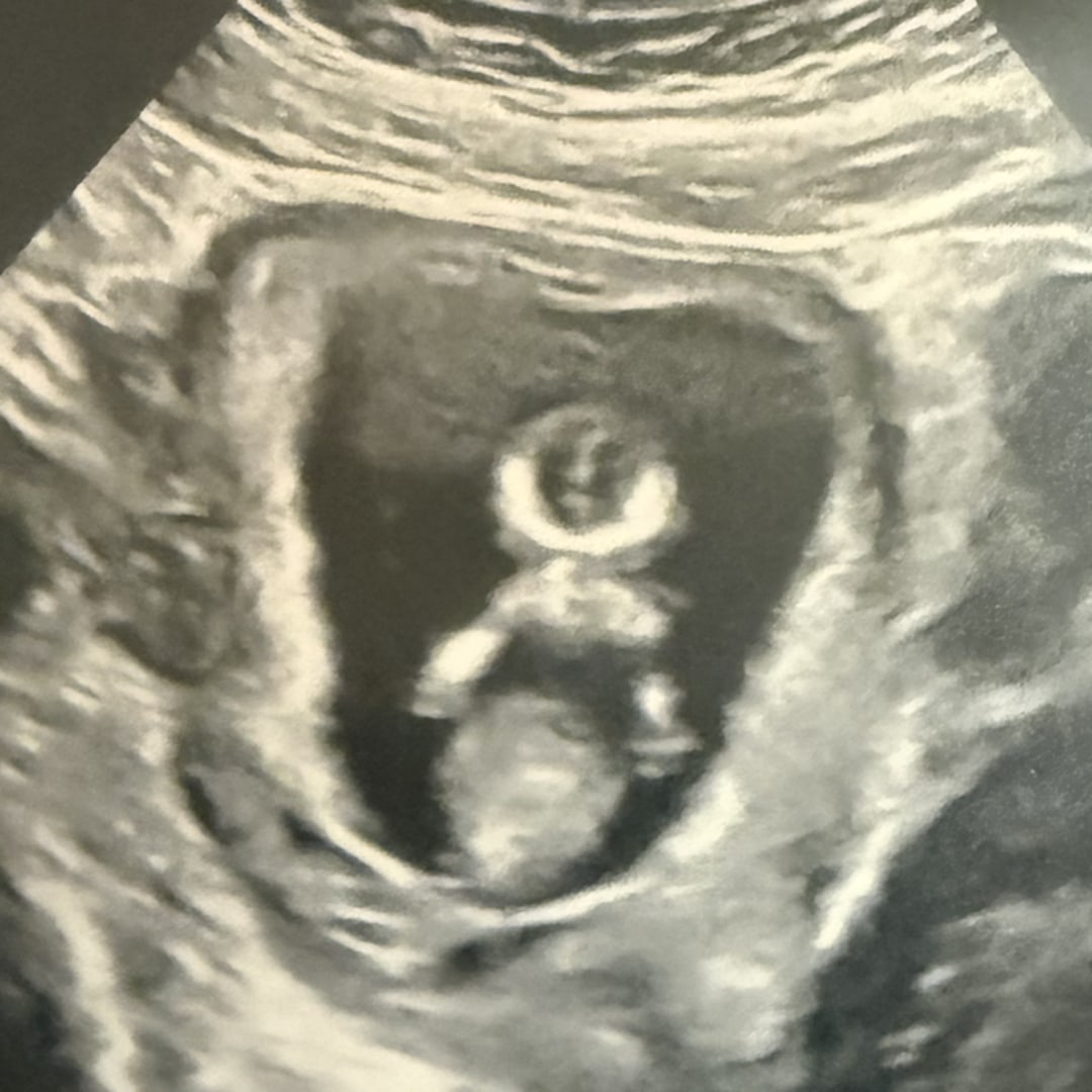 Photo shared by Abigail for their Babylist baby registry.