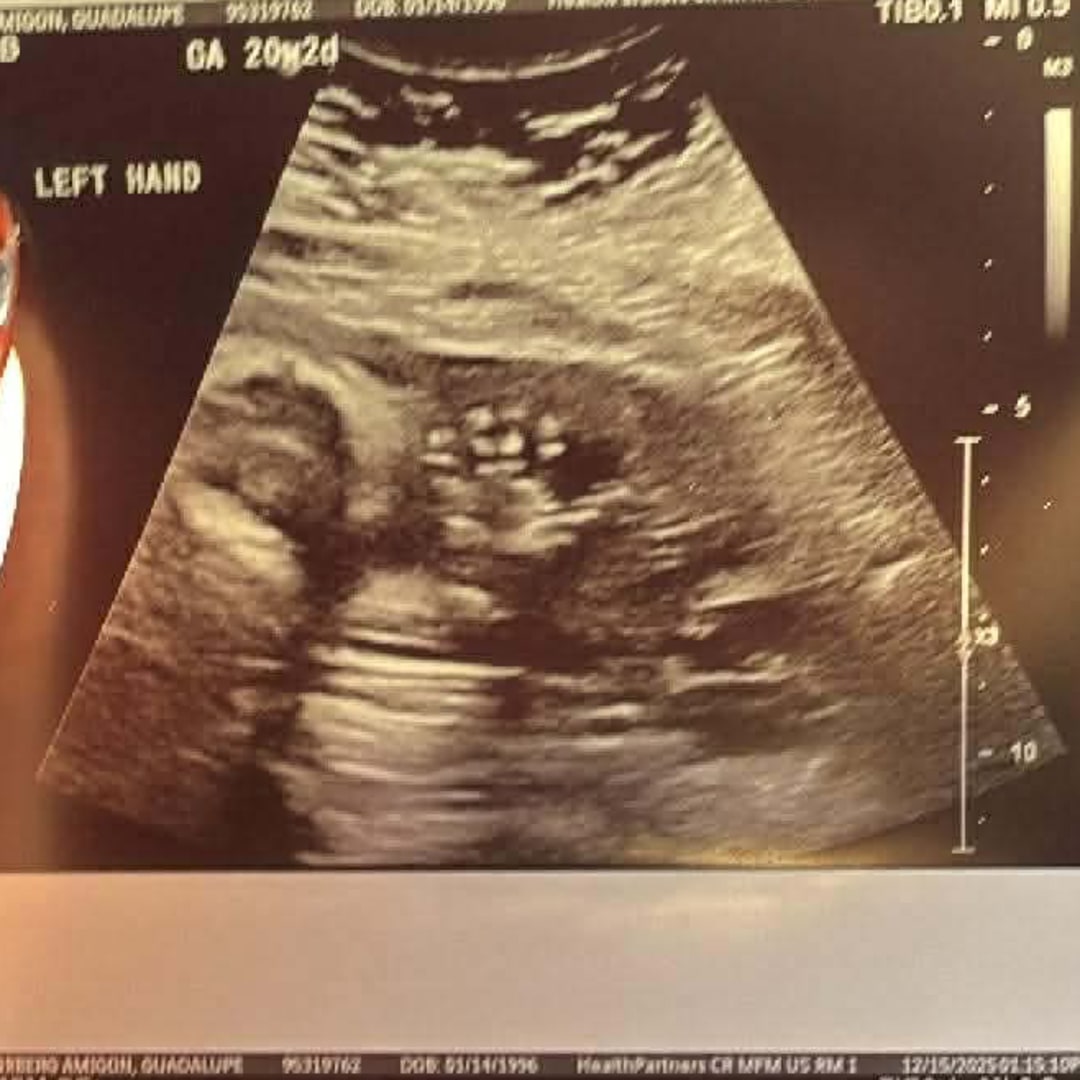 Photo shared by Lupe for their Babylist baby registry.