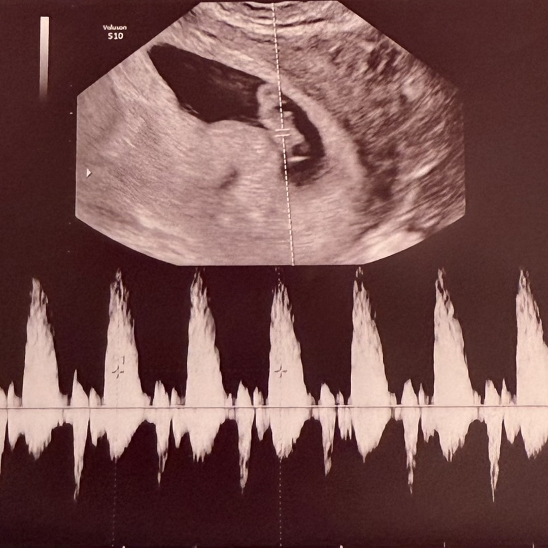 Photo shared by Deztiny for their Babylist baby registry.