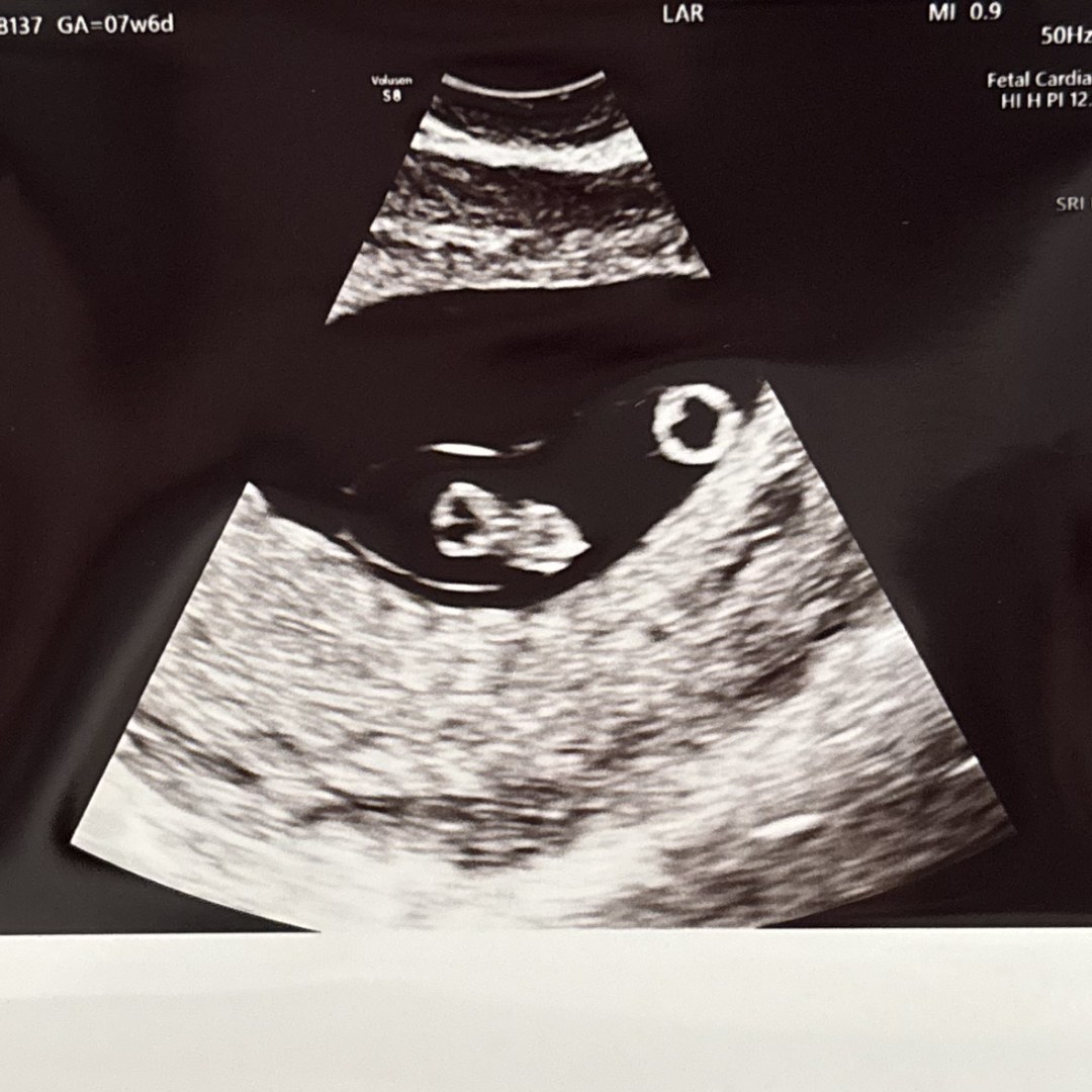 Photo shared by Jaeda for their Babylist baby registry.