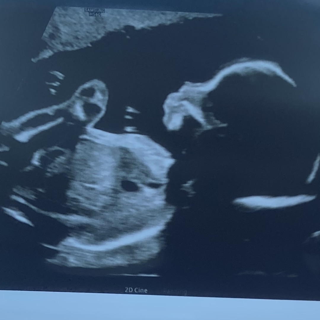 Photo shared by Brianna for their Babylist baby registry.