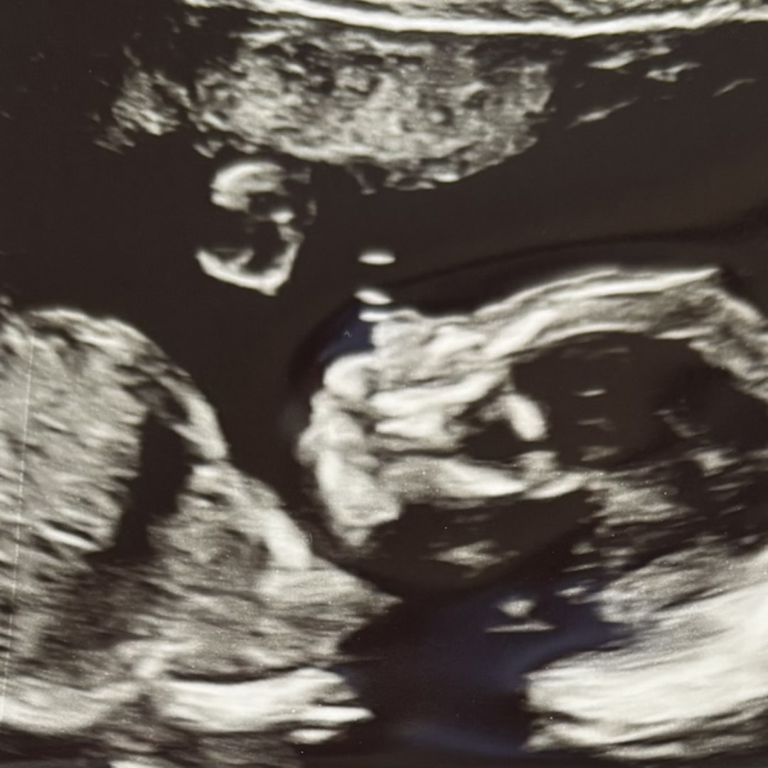 Photo shared by Megan for their Babylist baby registry.