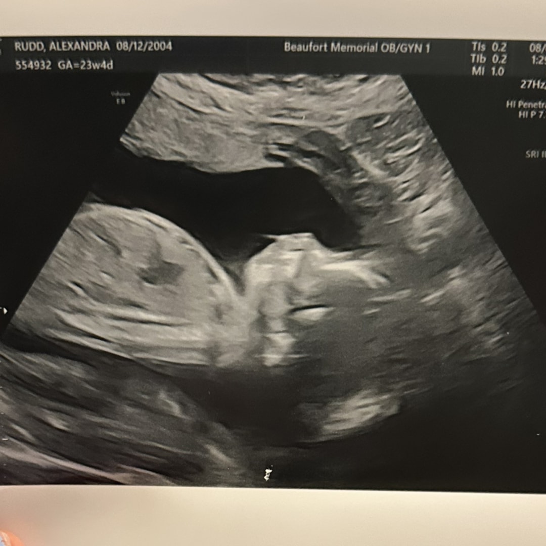 Photo shared by Alexandra for their Babylist baby registry.