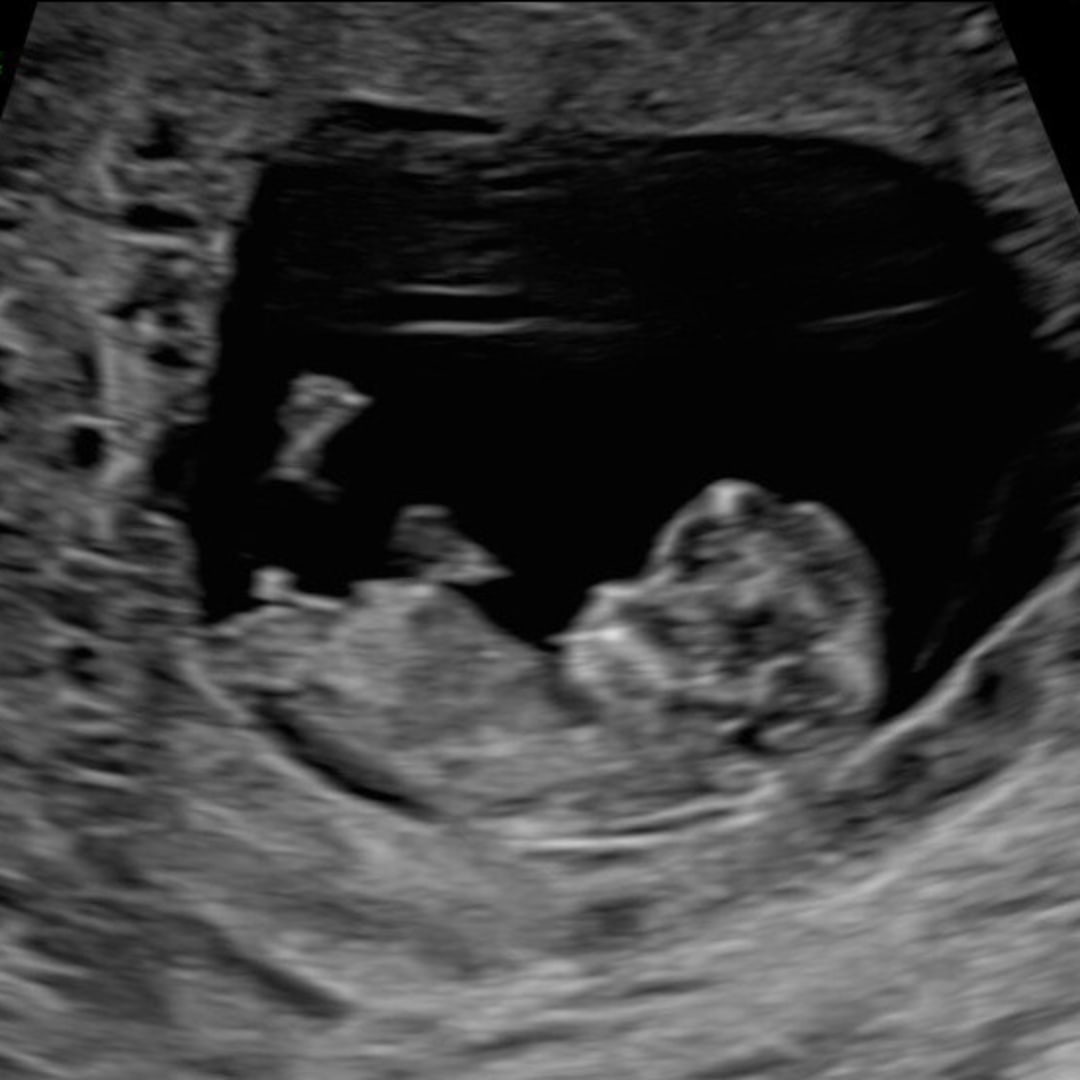 Photo shared by Ella for their Babylist baby registry.