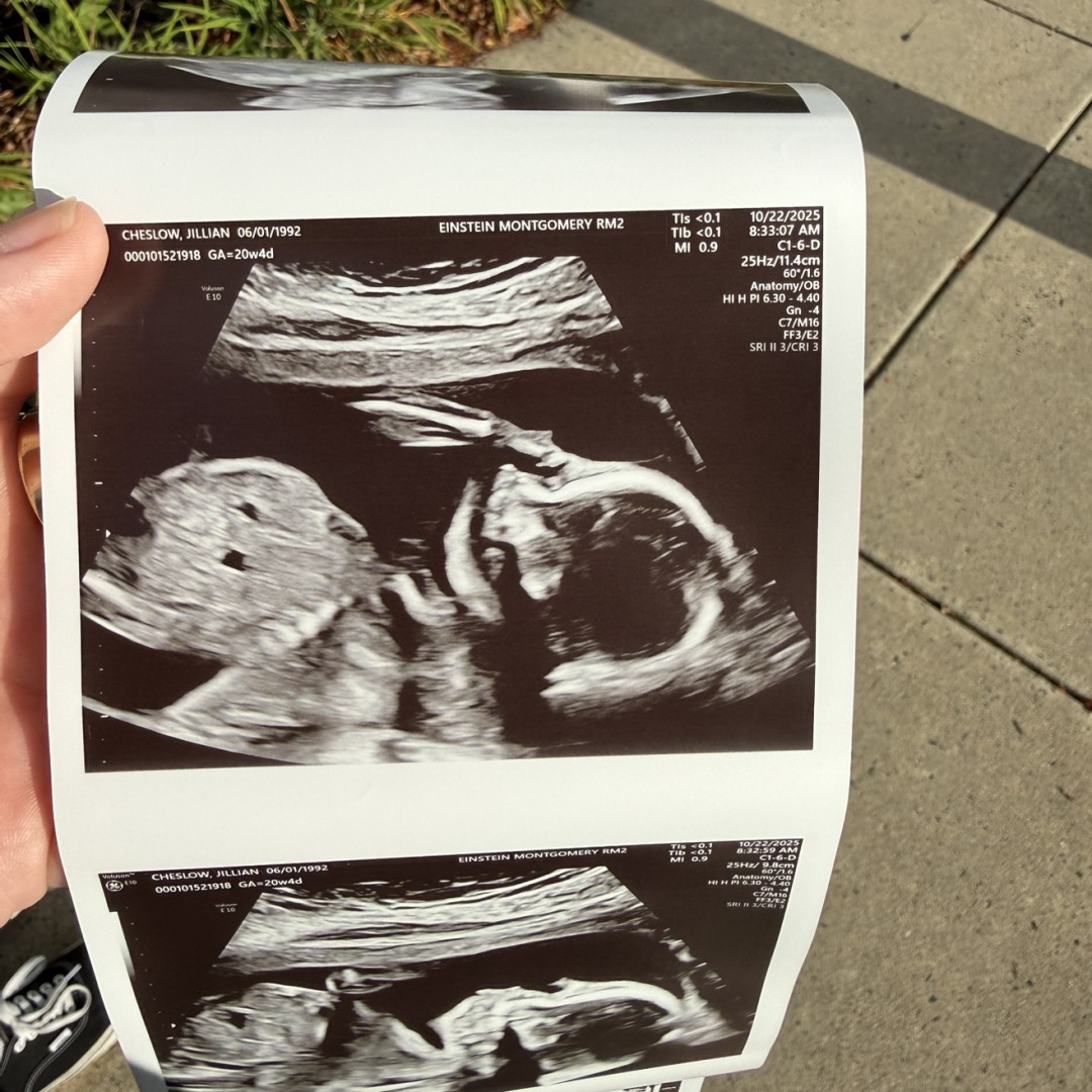 Photo shared by Jillian for their Babylist baby registry.