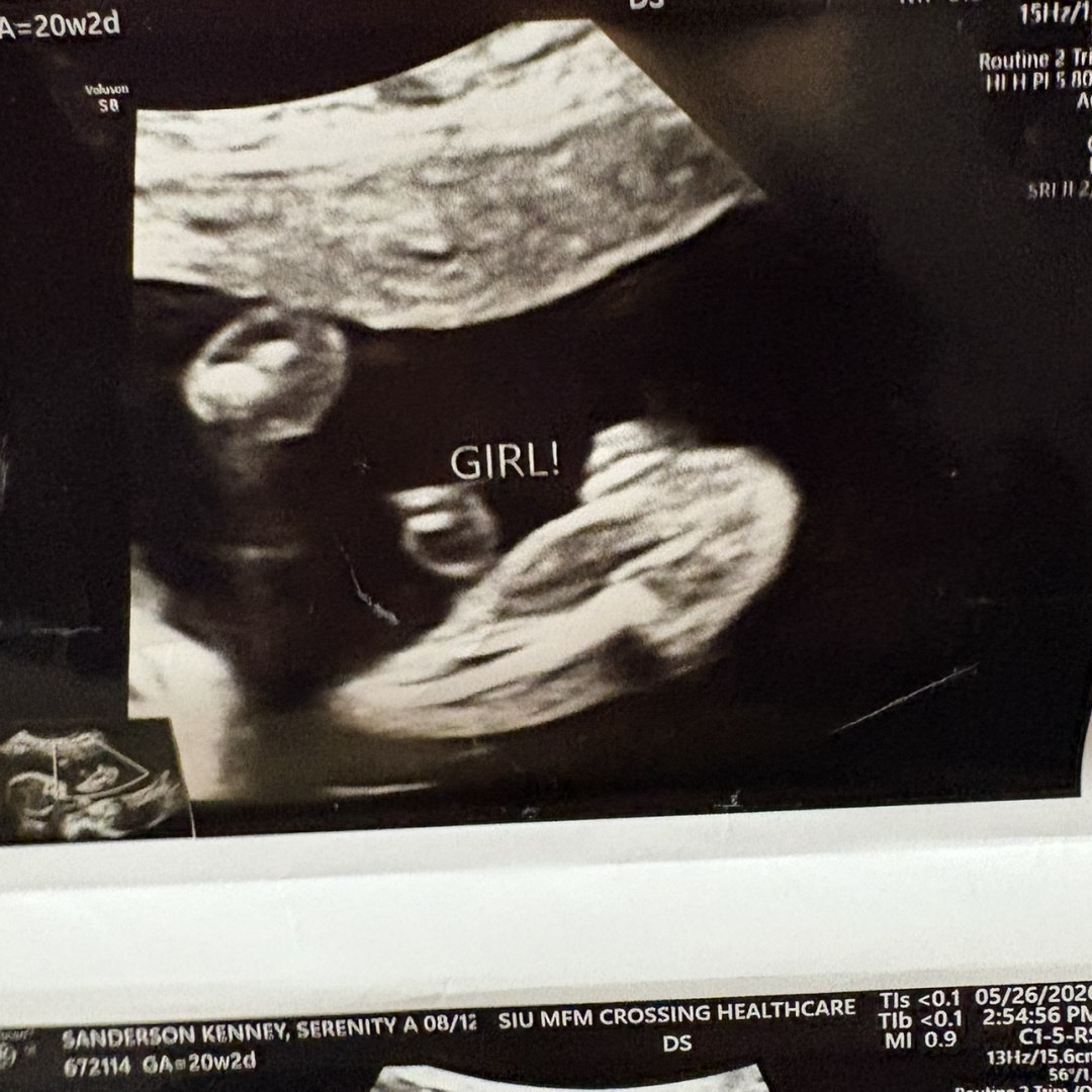 Photo shared by Serenity for their Babylist baby registry.