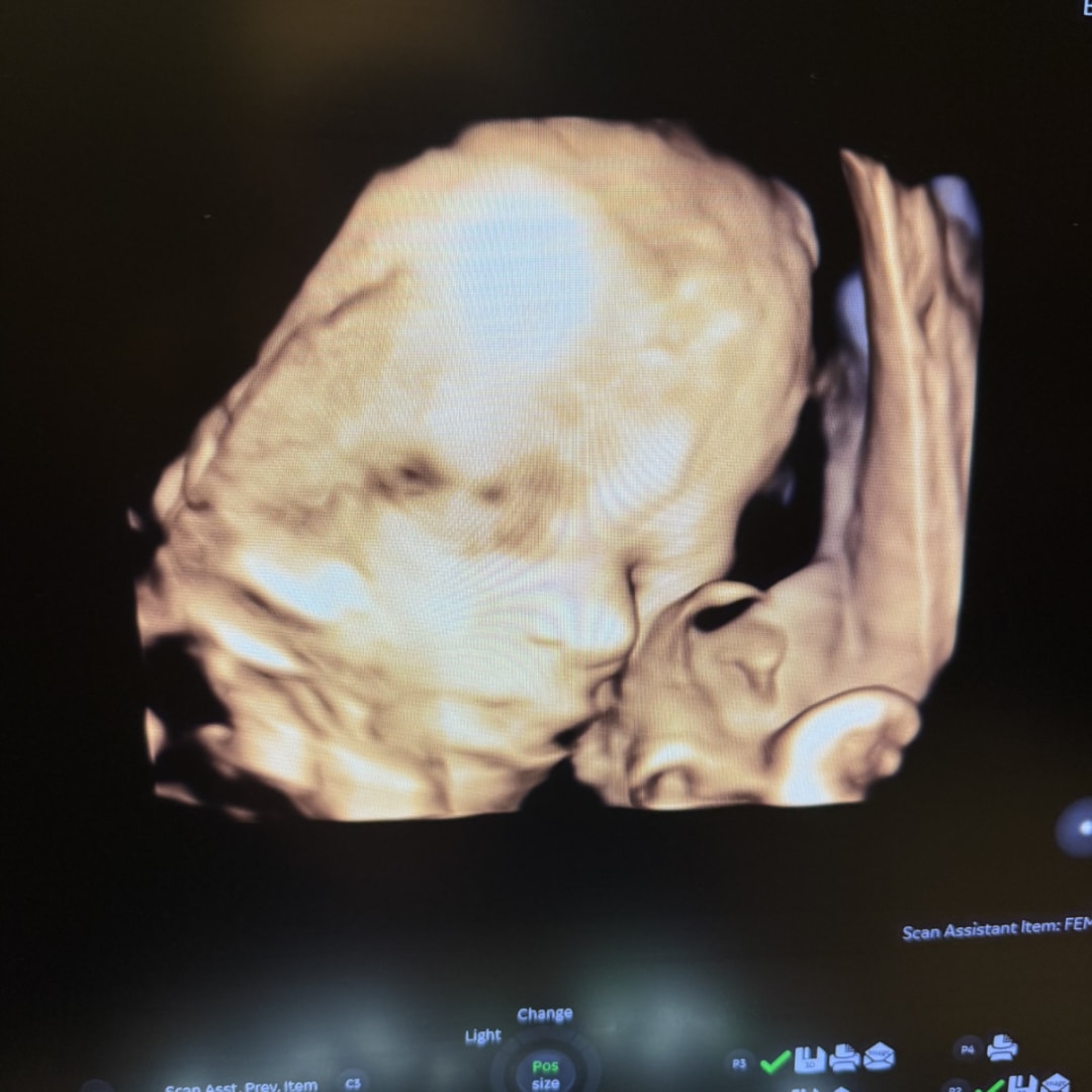 Photo shared by Brittany for their Babylist baby registry.
