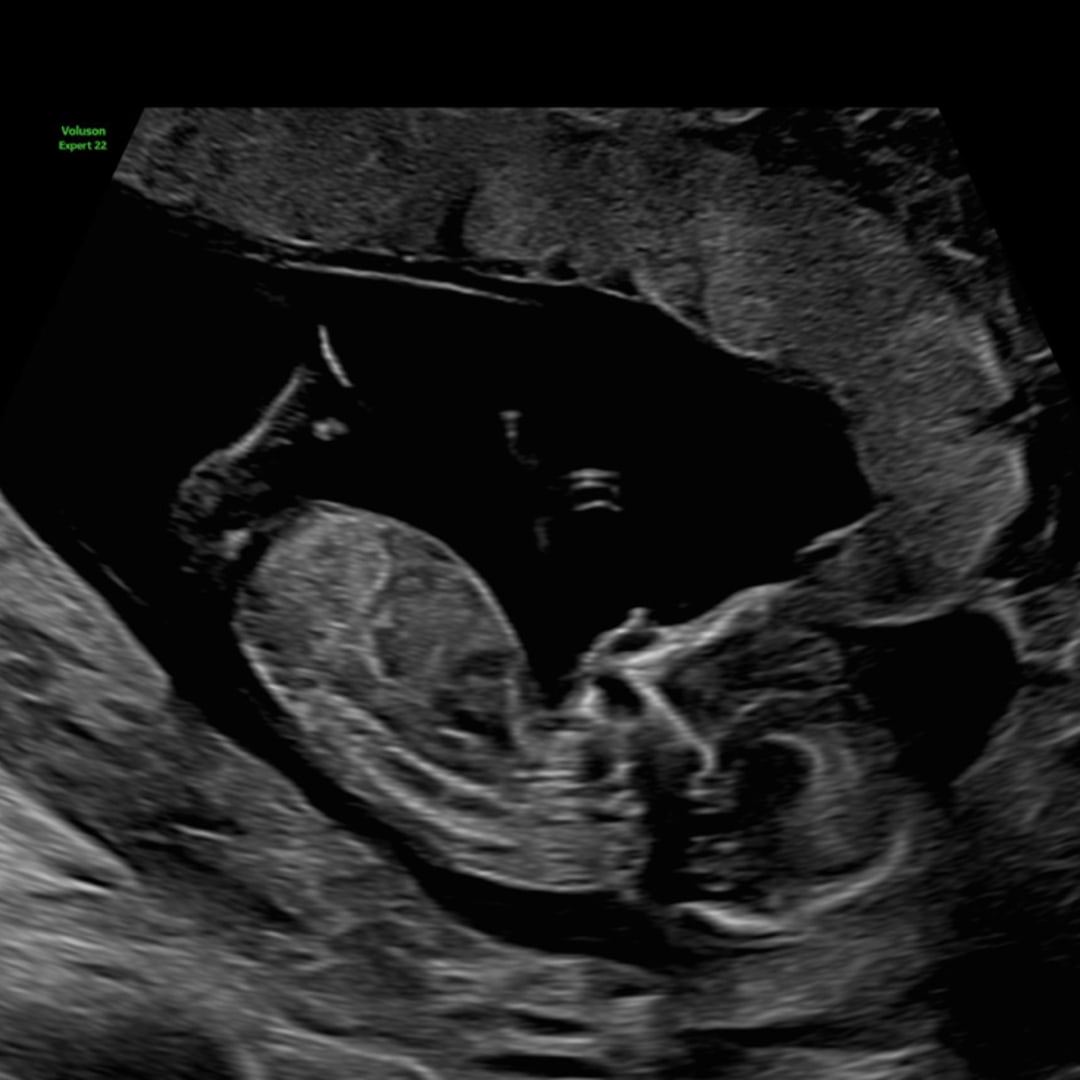 Photo shared by Daniela for their Babylist baby registry.