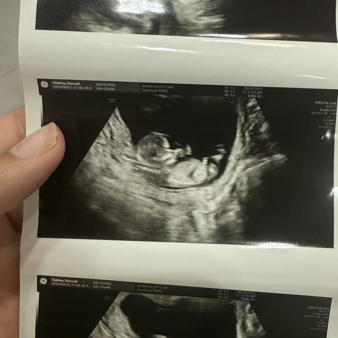 Photo shared by Hannah for their Babylist baby registry.
