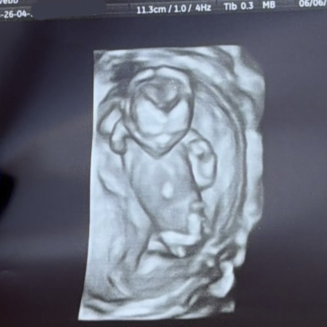 Photo shared by Bailey for their Babylist baby registry.