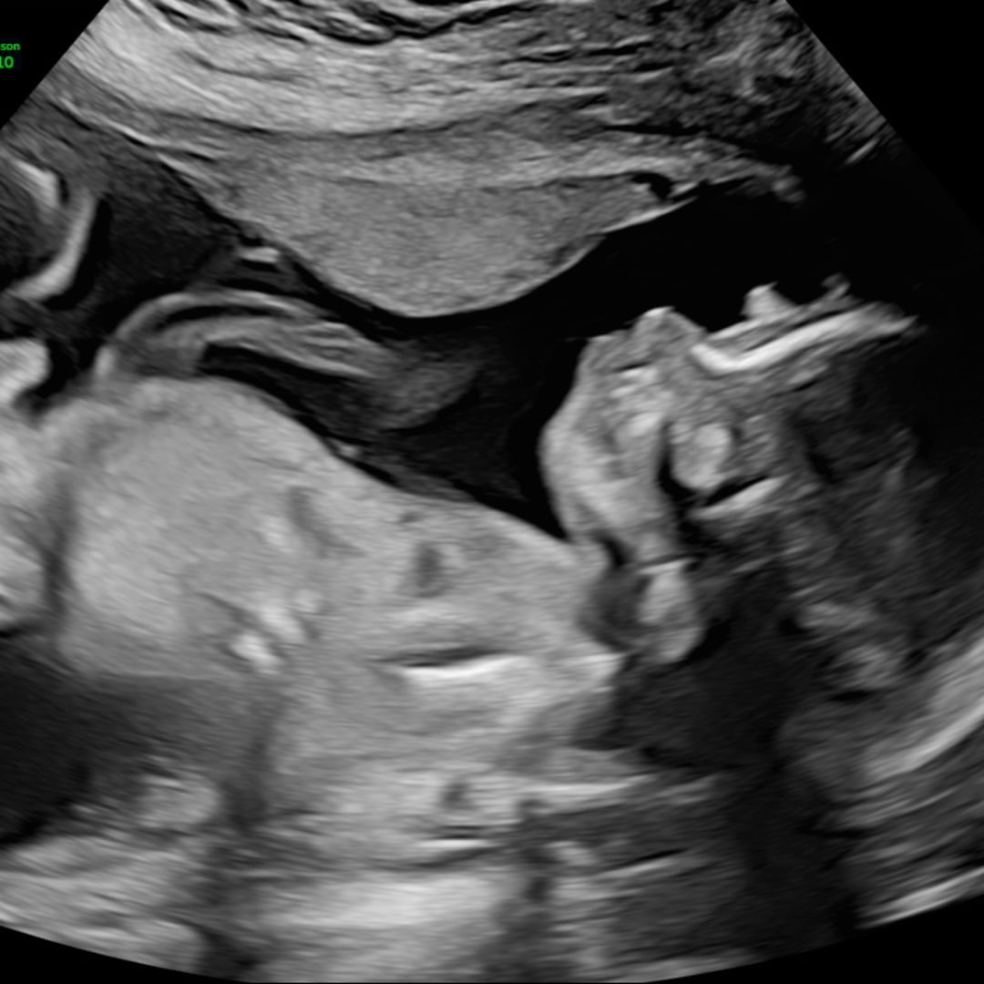 Photo shared by Amariah for their Babylist baby registry.