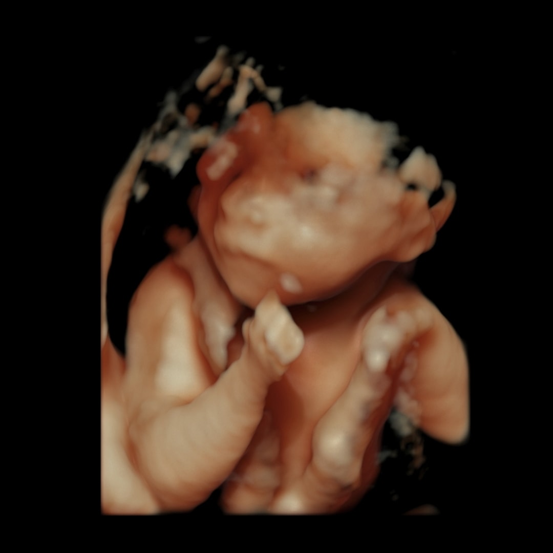 Photo shared by Jadyn for their Babylist baby registry.