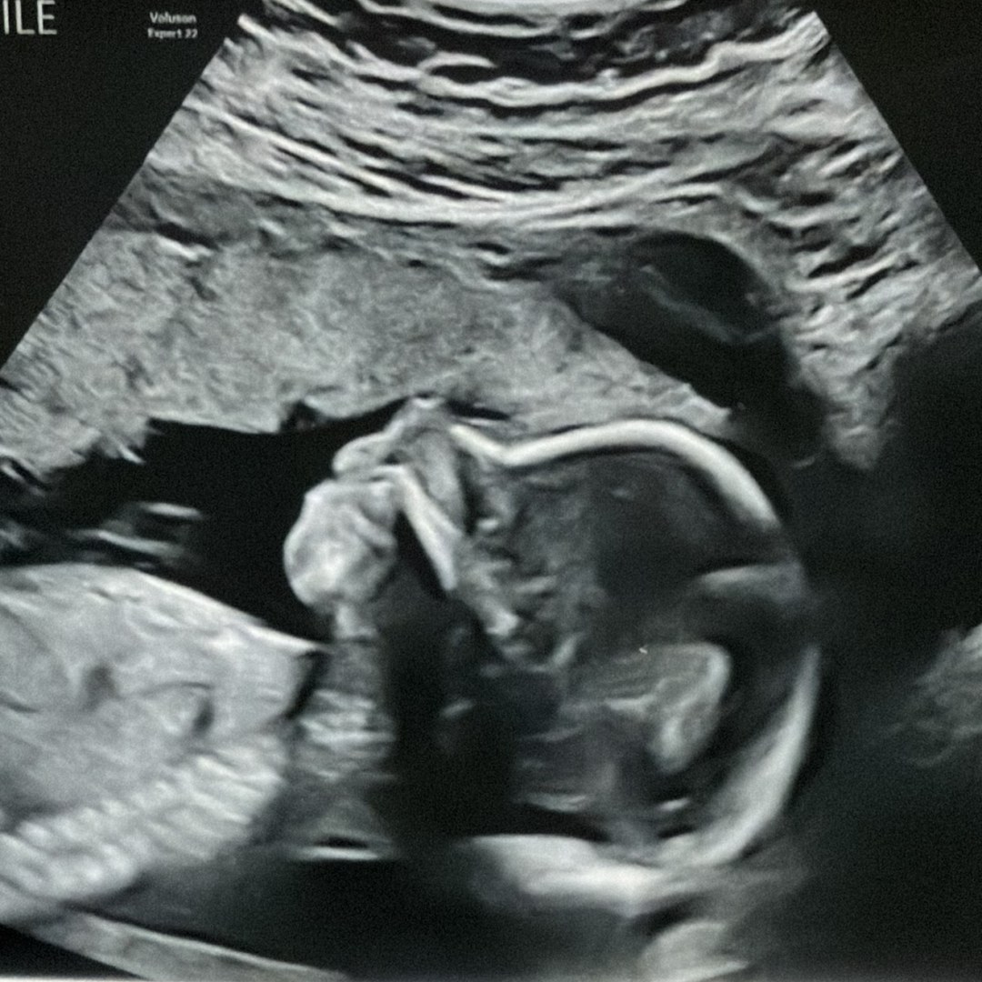 Photo shared by Ivy for their Babylist baby registry.