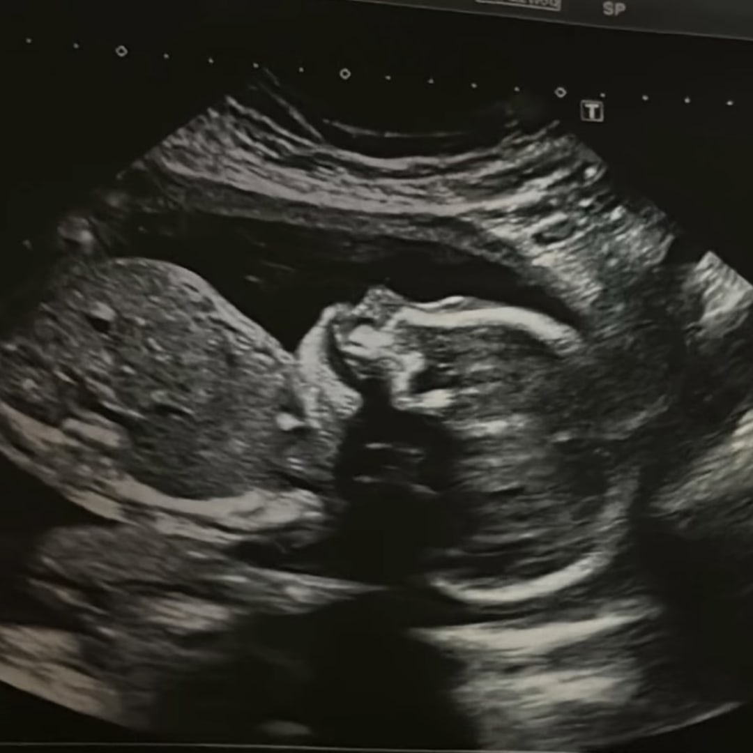 Photo shared by Alisha for their Babylist baby registry.