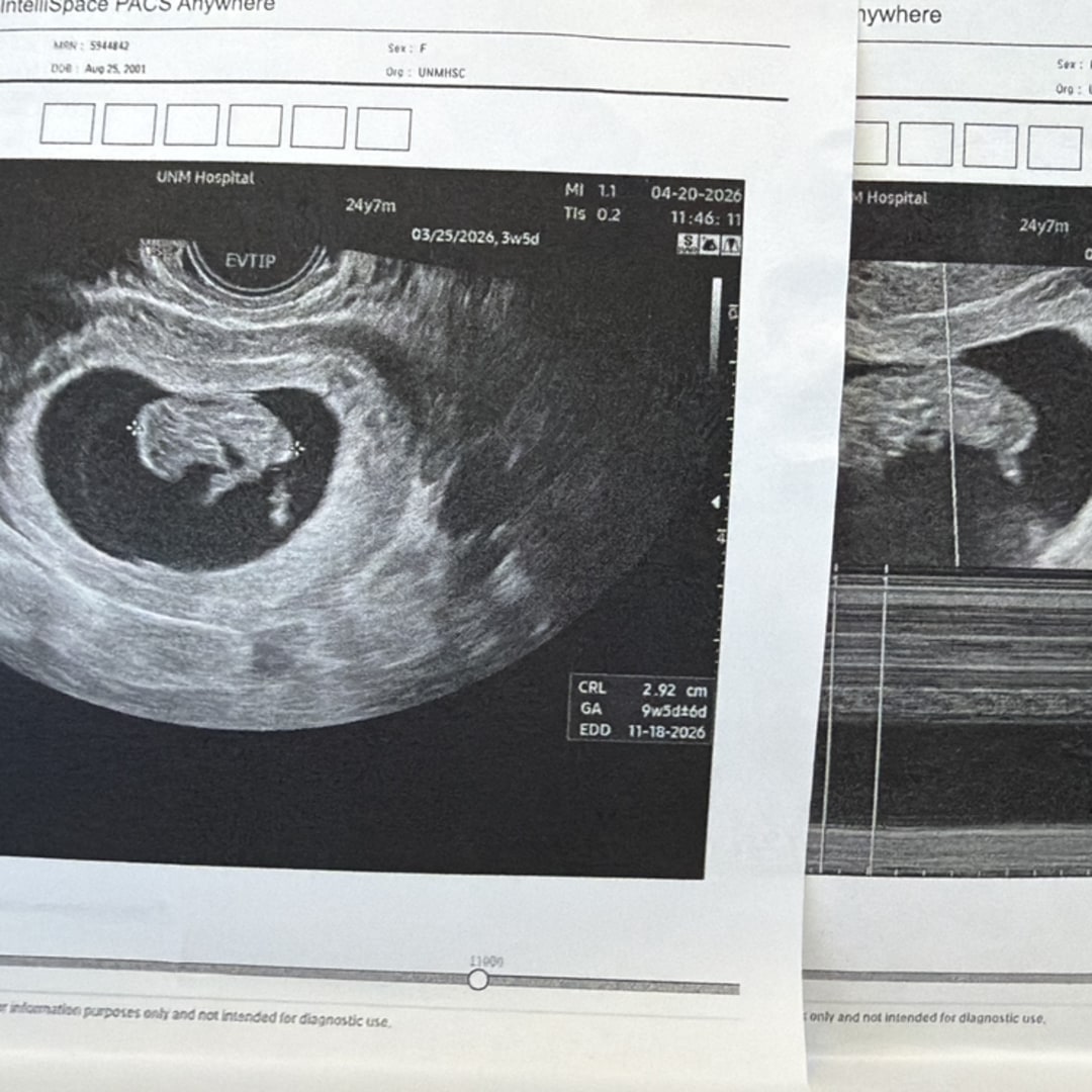 Photo shared by Gwendolyn for their Babylist baby registry.