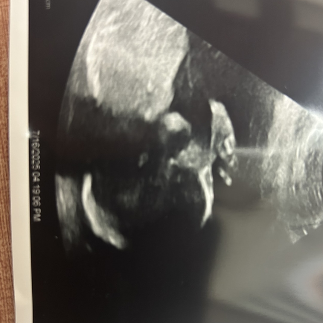 Photo shared by Sayhanna for their Babylist baby registry.